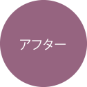 アフター